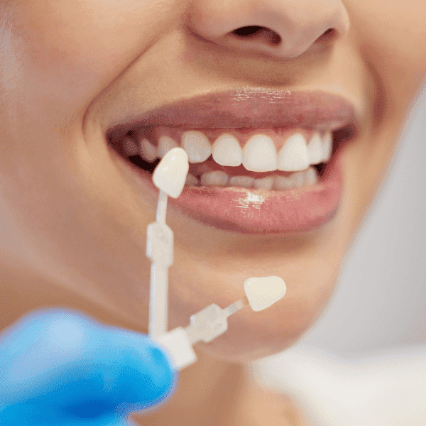 Kartal Hürriyet invisalign - diş kaplama