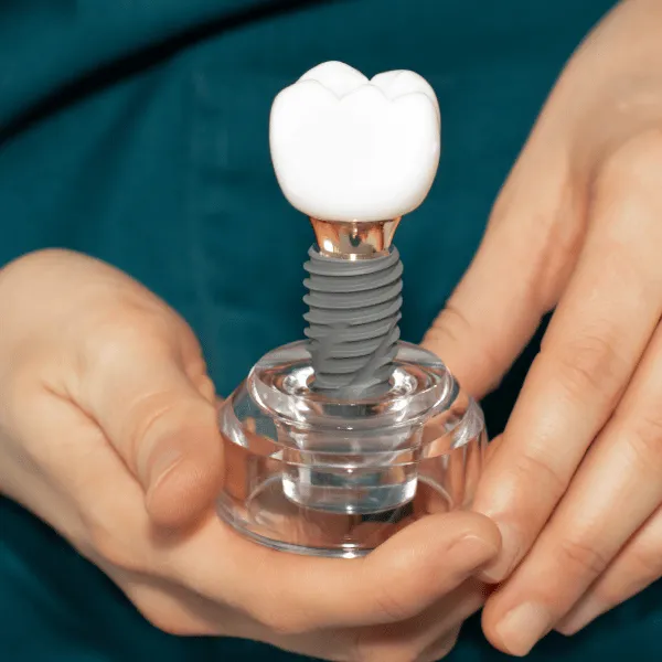 Kartal Dental Implant Treatment The Most Effective Way to Regain Your Complete Smile